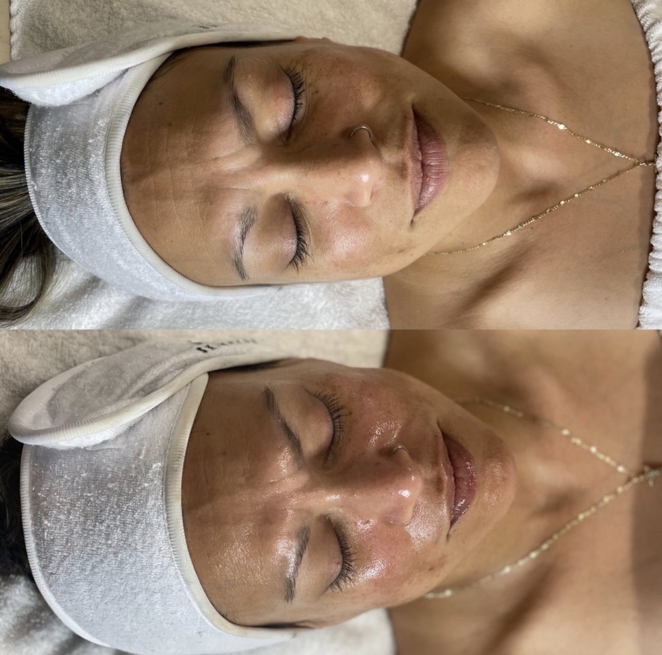 Real client before and after results at K&K Facial Spa