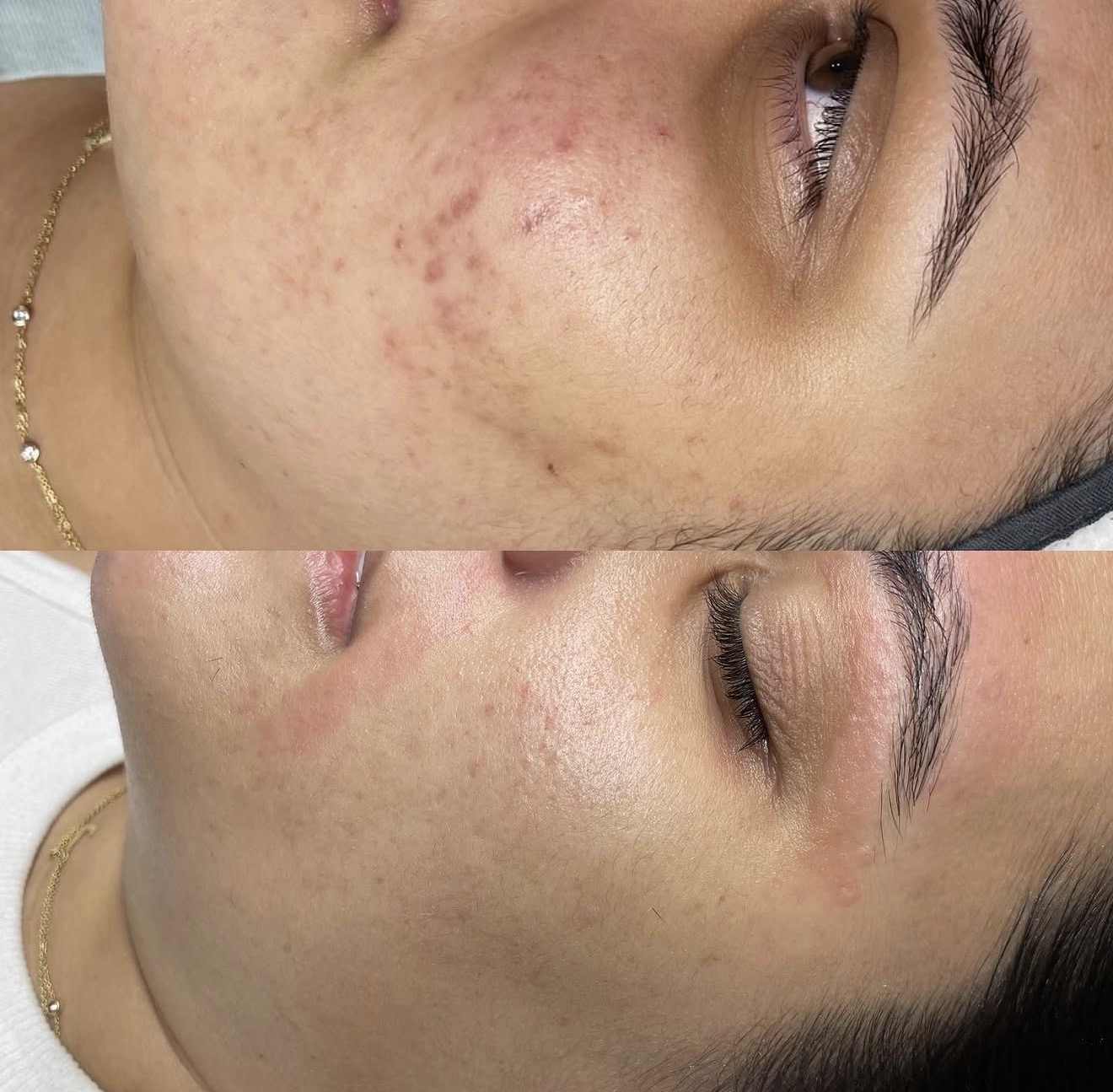Real client before and after results at K&K Facial Spa