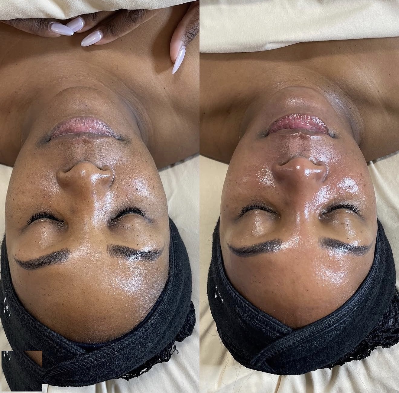 Real client before and after results at K&K Facial Spa