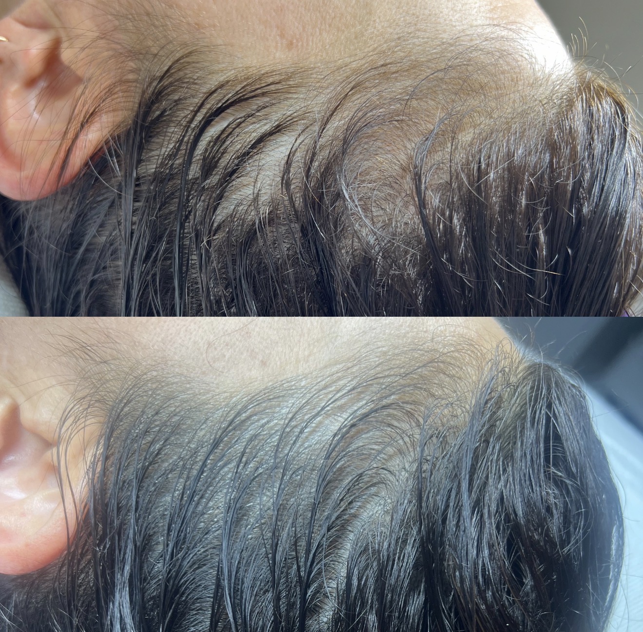 Real client before and after results at K&K Facial Spa